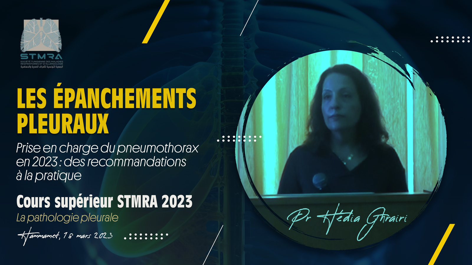 Prise en charge du pneumothorax en 2023 : des recommandations à la pratique