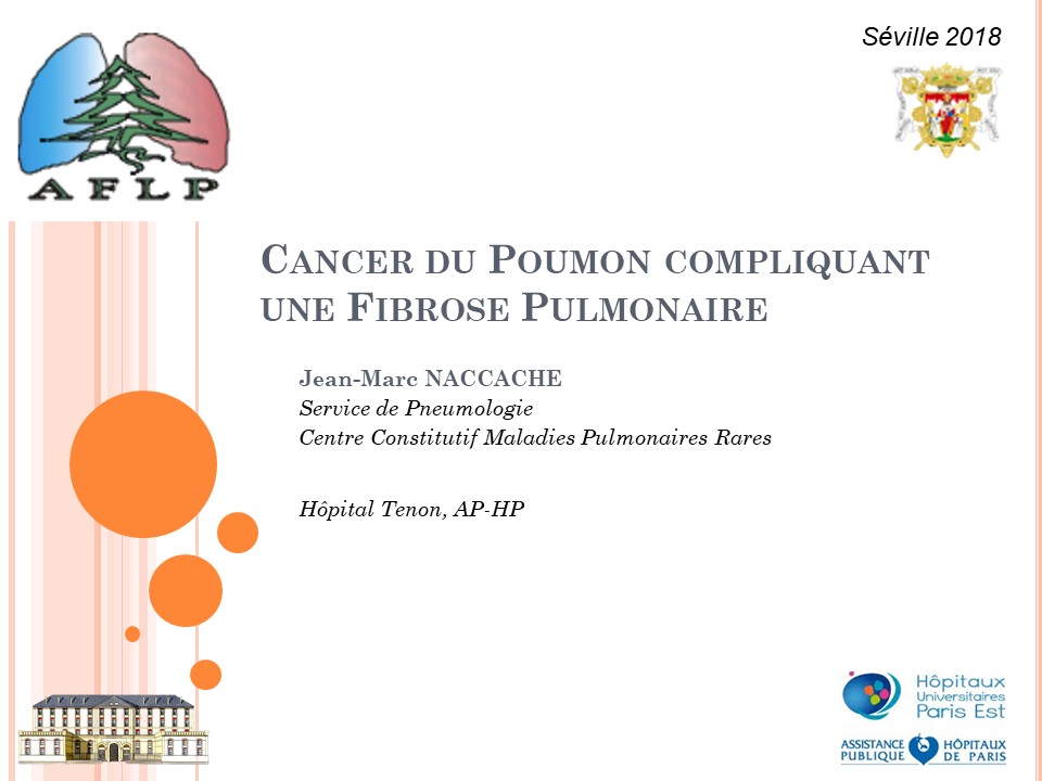 Cancer du poumon compliquant une fibrose pulmonaire. Jean Marc Naccache