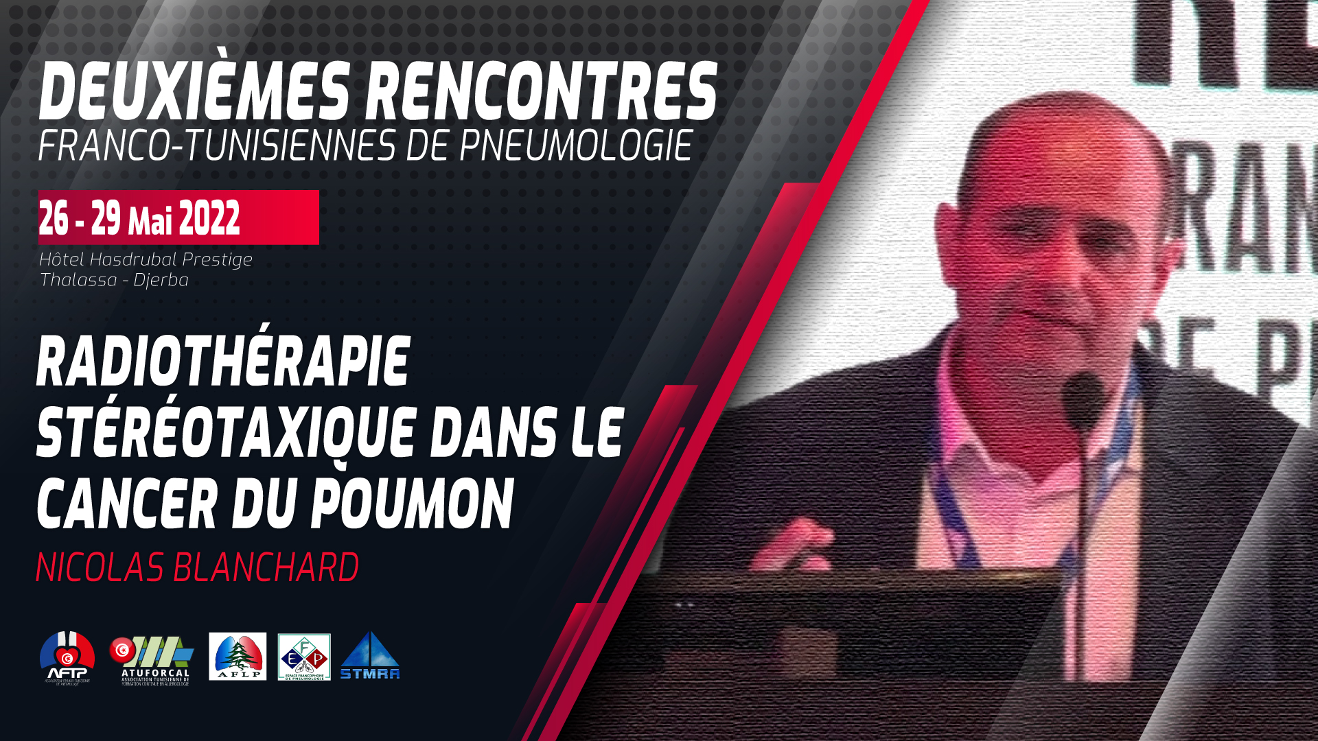 Radiothérapie stéréotaxique dans le cancer du poumon. Nicolas Blanchard