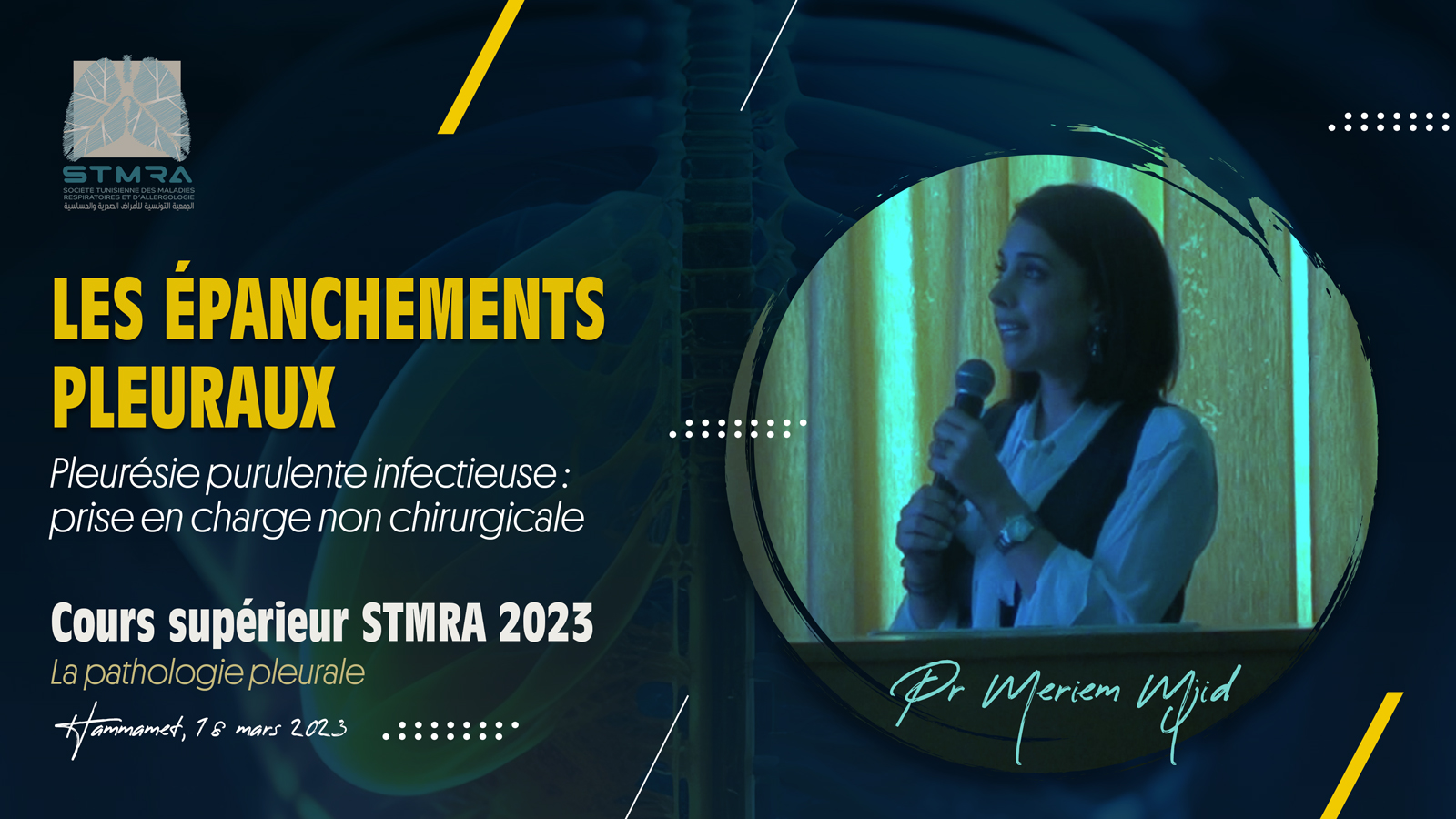 Pleurésie purulente infectieuse : prise en charge non chirurgicale