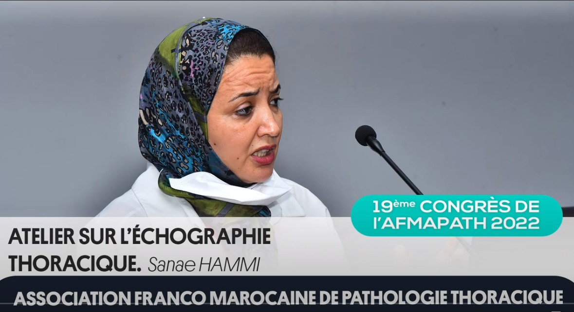 Atelier sur l'échographie thoracique. Sanae HAMMI