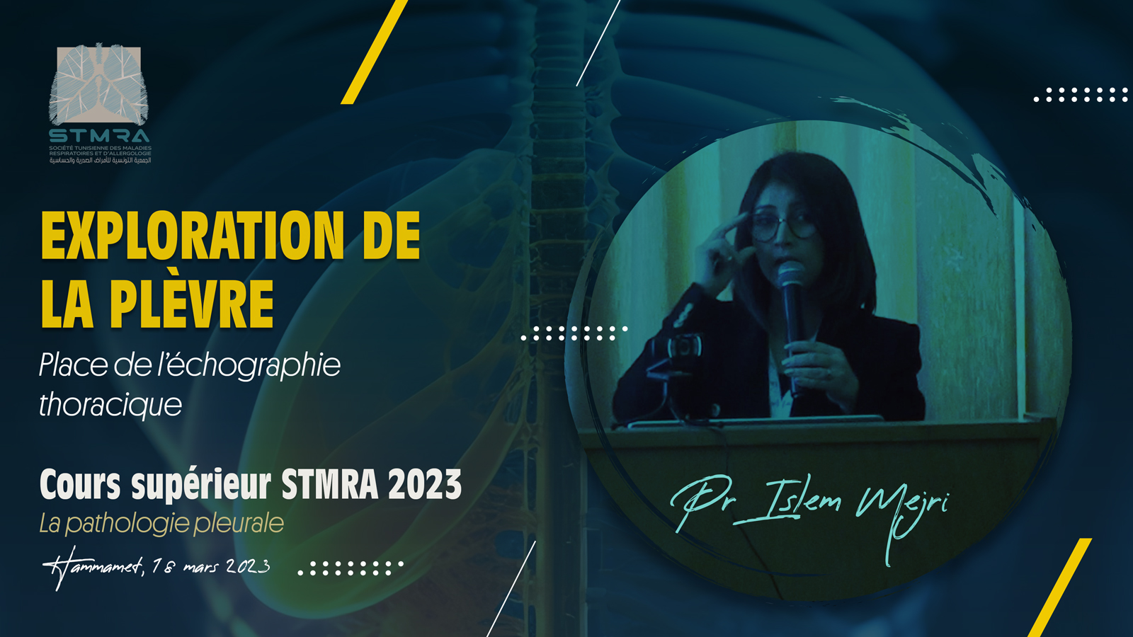 Place de l'échographie thoracique dans l'exploration de la plèvre