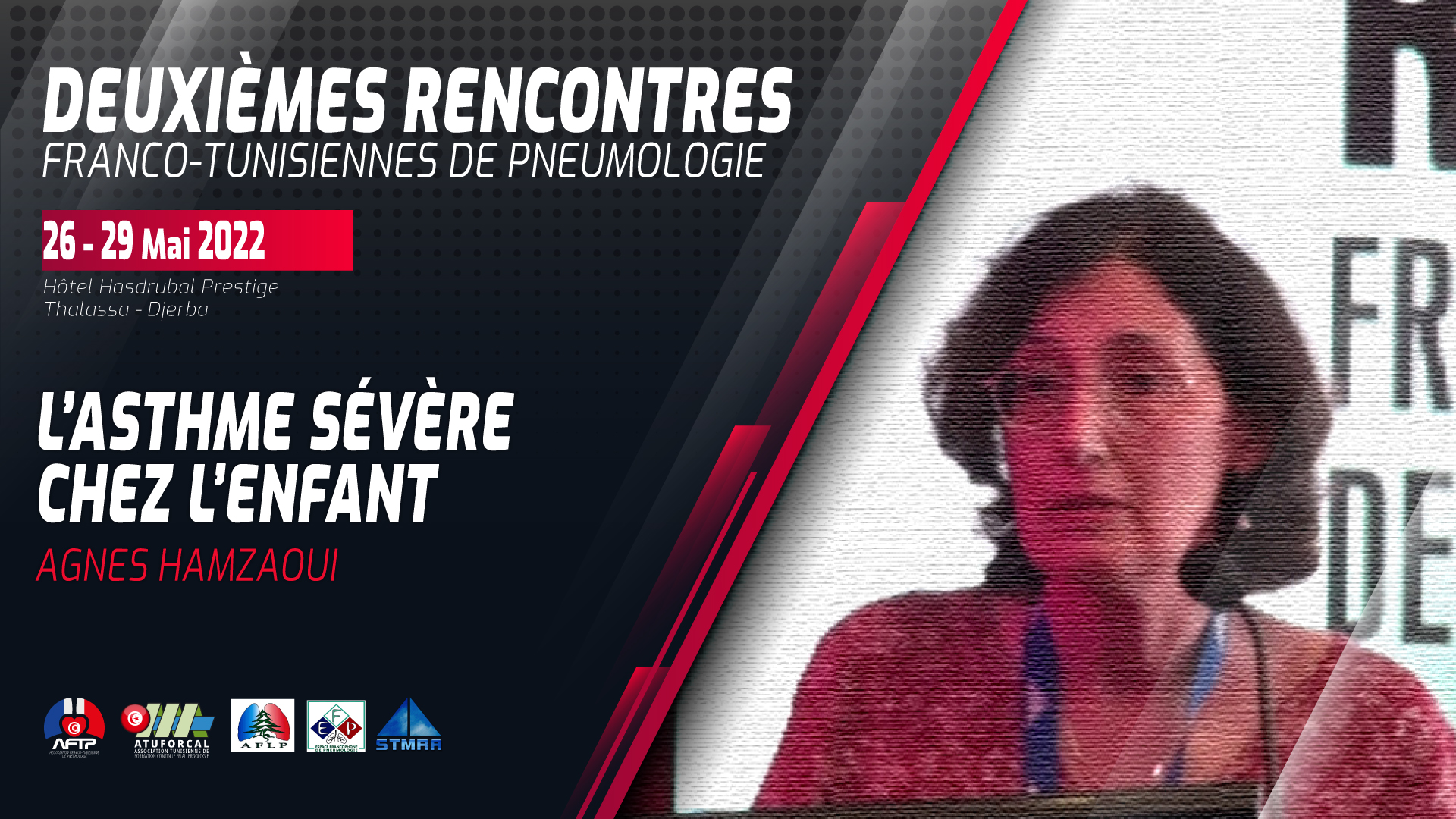 Asthme sévère chez l’enfant. Agnès Hamzaoui
